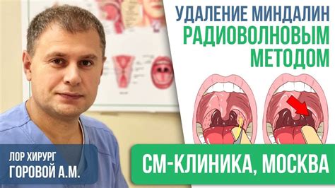 Удаление миндалин: как происходит операция?