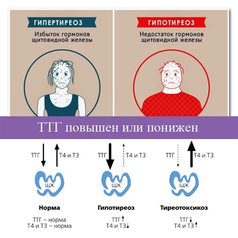 Уровень гормонов щитовидной железы при длительном стрессе