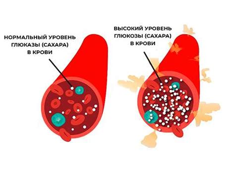 Фруктовый лед и диабет 2 типа: что нужно знать