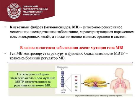 Хирургическое вмешательство при муковисцидозе у взрослых