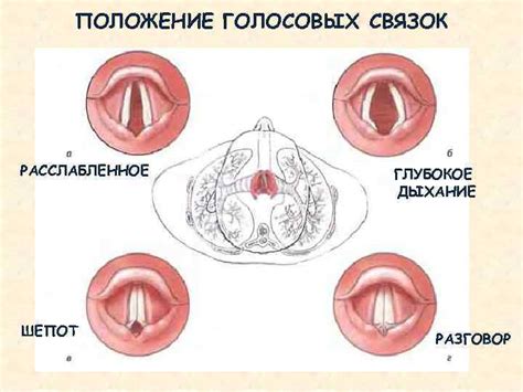 Хирургическое увеличение голосовых связок