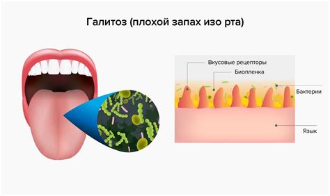 Что такое запах изо рта и почему он возникает у детей?