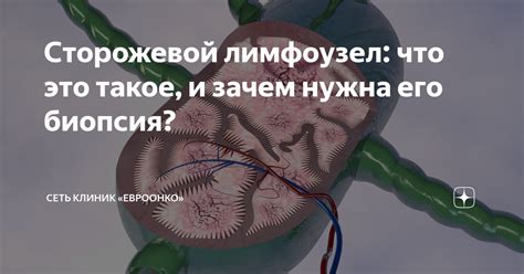 Что такое лимфоузел и зачем он нужен?