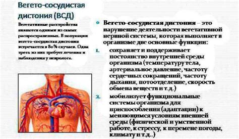 Что такое сердечно-сосудистая дистония