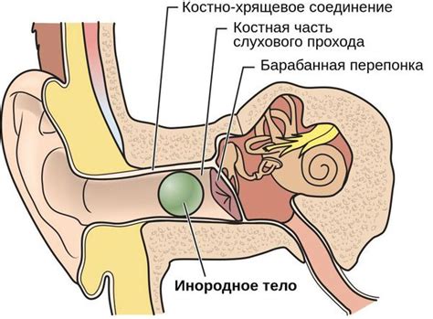 Что такое шевеление в ухе?