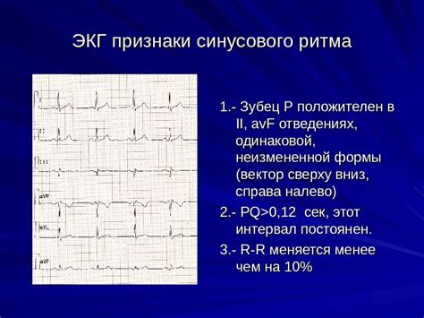 ЭКГ признаки употребления парить