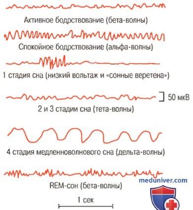  Концентрация во время сна: фокусируйтесь на формировании и расширении водной области 