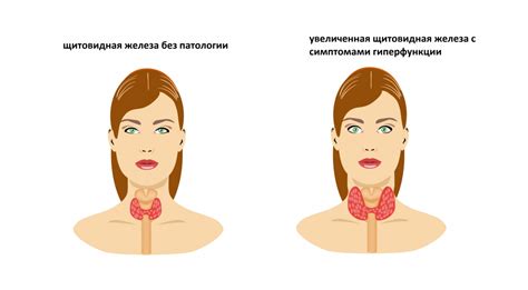  Ограничения по питанию при сдаче крови на ТТГ 