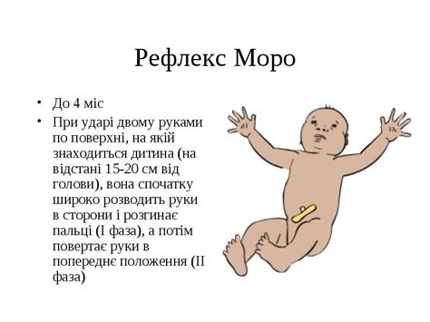 4. Рефлекс Моро: самый защитный.